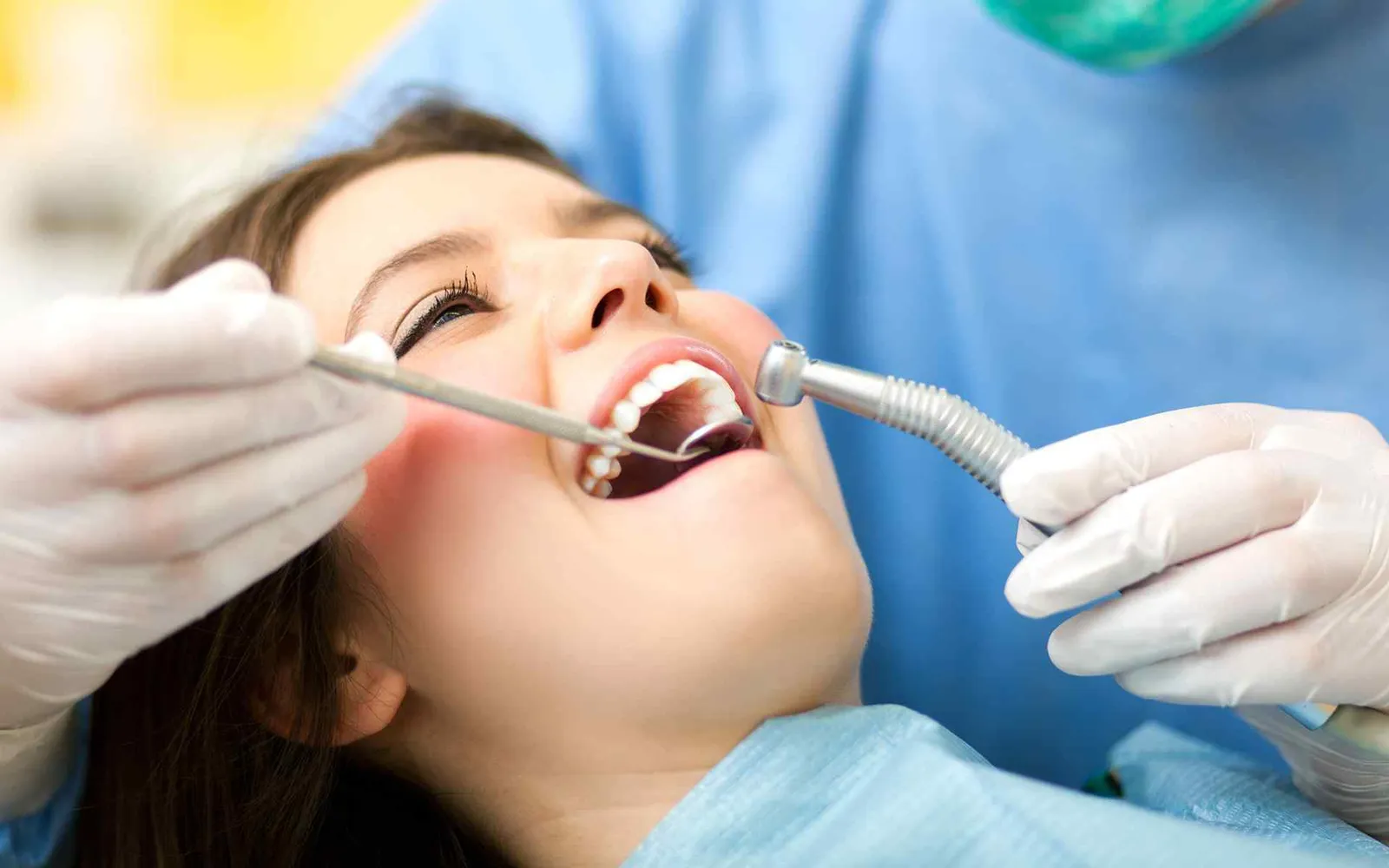 Estética Dental