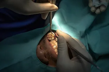 Periodoncia
