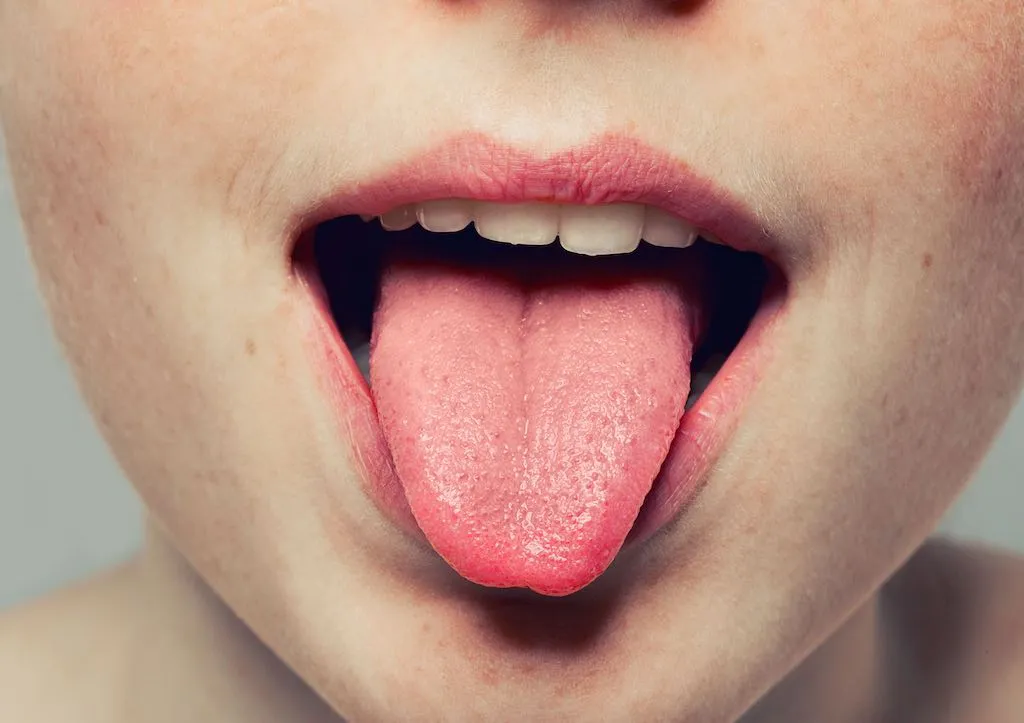 Causas de los puntos rojos de la lengua