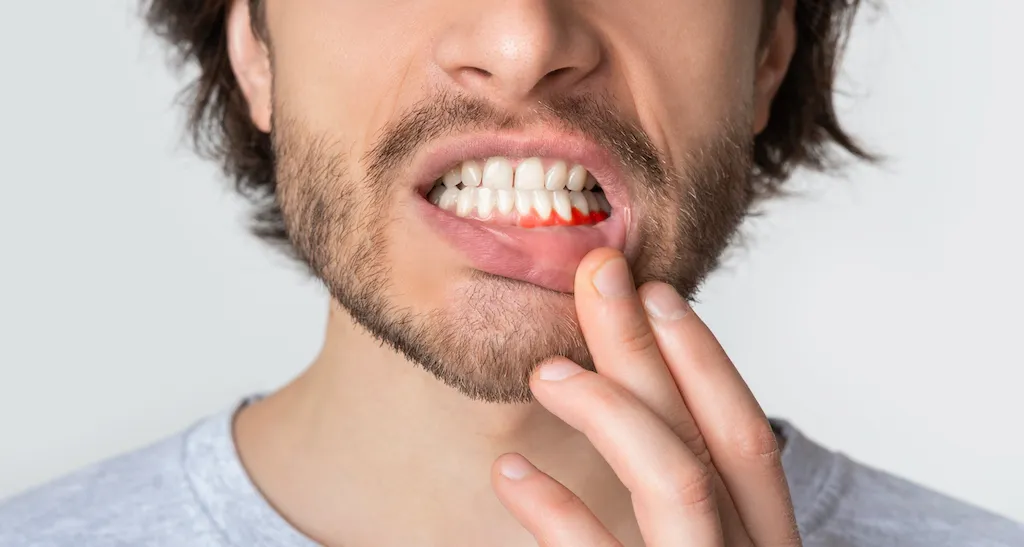 dolor de encias