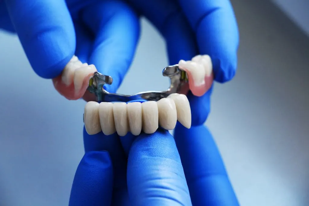 Descubre los puentes dentales