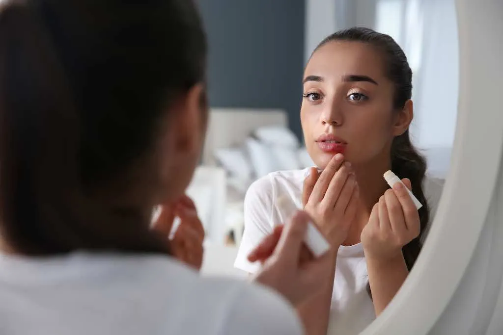 herpes labial que es