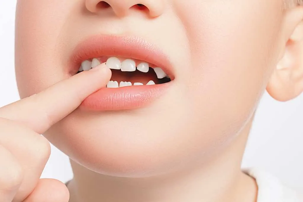 que son los dientes de leche