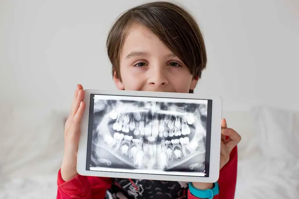 problemas en dientes niños