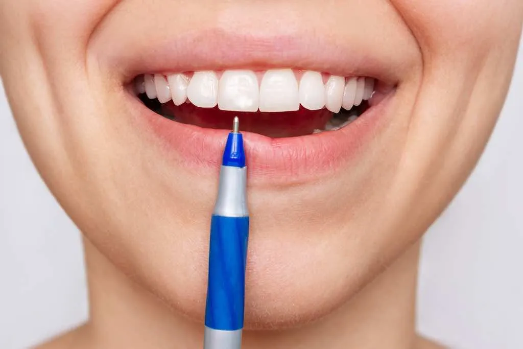 Manchas blancas en los dientes: causas y tratamientos